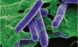Vi khuẩn Clostridium botulinum và cách phòng tránh ngộ độc thực phẩ...